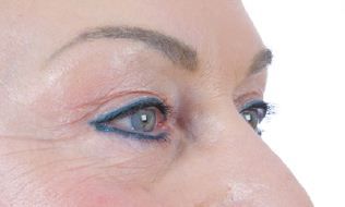 augen