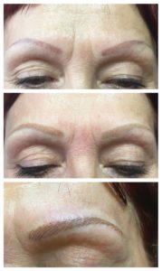 18-rötliche-unsymmetrische-Verzeichnung-Brauenneugestaltung-und-Korrektur-durch-Permanent-Make-up-Spezialistin-Birgit-Schneider_1100x1146