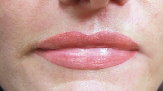 Lippenvollzeichnung