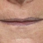 schmale Lippen