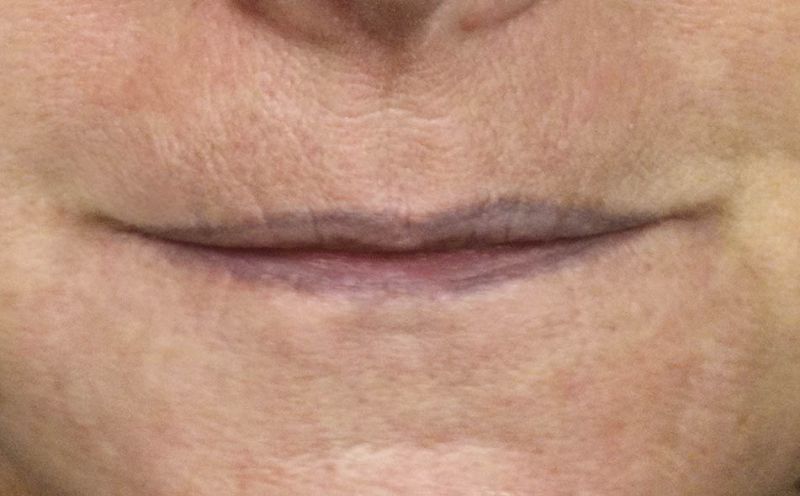 schmale Lippen schmale Lippen